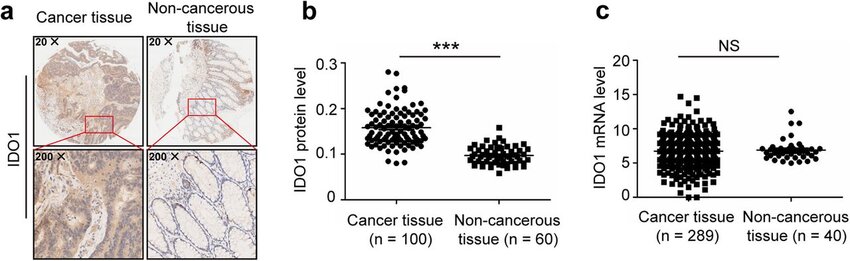 The protein and mRNA expression patterns of IDO1 are different in human colon cancer. a Representative IHC staining of IDO1 in human colon cancer tissues and adjacent noncancerous tissues. b IDO1 protein expression of 100 colon cancer tissues and 60 adjacent noncancerous tissues by IHC in a tissue microarray. The data were quantified by measuring the mean density of all the DAB stained areas of each micrograph using Image-Pro Plus 6.0 software, and the Y-axis for “IDO1 protein level” represents the mean density of DAB staining (integral optical density (IOD) / area of interest (AOI)). c IDO1 mRNA expression between 289 colon cancer tissues and 40 adjacent noncancerous tissues. The data were downloaded from TCGA. b, c Two-tailed Student’s t-test was performed for statistical analysis; ***P < 0.001, NS: not significant