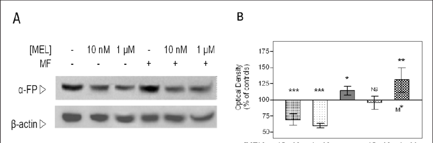 (A) Representative immunoblots for alpha-fetoprotein (AFP) after treatment with 10 nM MEL or 1 μM MEL and/or MF. Load control: β-actin. (B) Quantitative Western blot for AFP. Means ± SEM of data normalized over controls. NS, not significant; *, p<0.05; ***, p<0.001. Significant differences between the results of the combined treatment (MEL+MF) and those of treatment with the equivalent dose of MEL only are also identified (M).