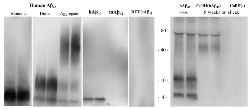 Western blot of beta-amyloid (Aβ). Beta-amyloid peptides (500 ng) were loaded onto gels and stained with a beta-amyloid antibody. Note that the antibody detected a 4 kDa monomer and an 8 kDa dimer peptide of human A42 and a 4 kDa peptide of human Aβ40 but not mouse A42. Human A42 was allowed to aggregate and showed a smear of higher 40-80 kDa aggregated species. As a negative control, a reversed (REV) peptide was loaded. When Aβ42 was incubated for eight weeks (without slices), three major bands were visible: at 4, 12 and approximately 80 kDa. Slices incubated for eight weeks with a collagen-loaded Aβ42 (CollH(Aβ42)) hydrogel showed two major bands at approximately 40 and 80 kDa, pointing to aggregation stages during long-term culturing, while no staining was visible in slices incubated with an empty collagen hydrogel (CollH(-)).